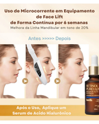 Massageador Facial V-Face com microcorrente EMS, LED e Vibração Lifting e Contorno Face